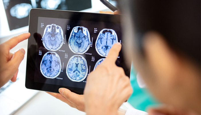 brain scan viewed on tablet