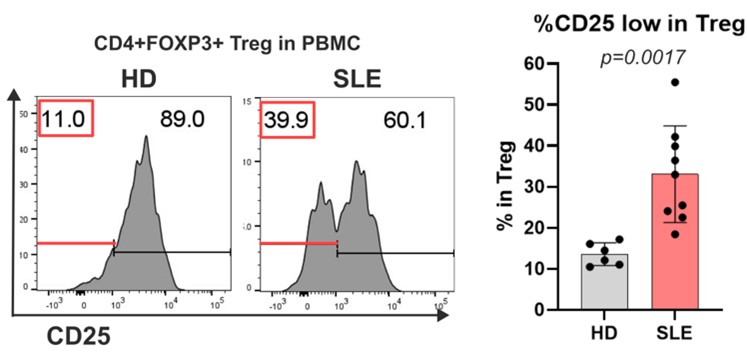 (Figure) CD25 expression on Treg cell in PBMC (peripheral blood mononuclear cell) derived from HD (healthy donor) or SLE (systemic lupus erythematosus) patients highlighting CD25 high and low populations. 